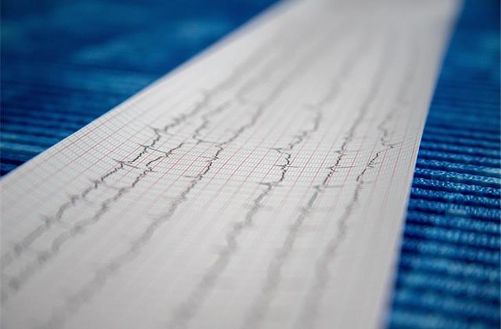 ECG monitoring equipment