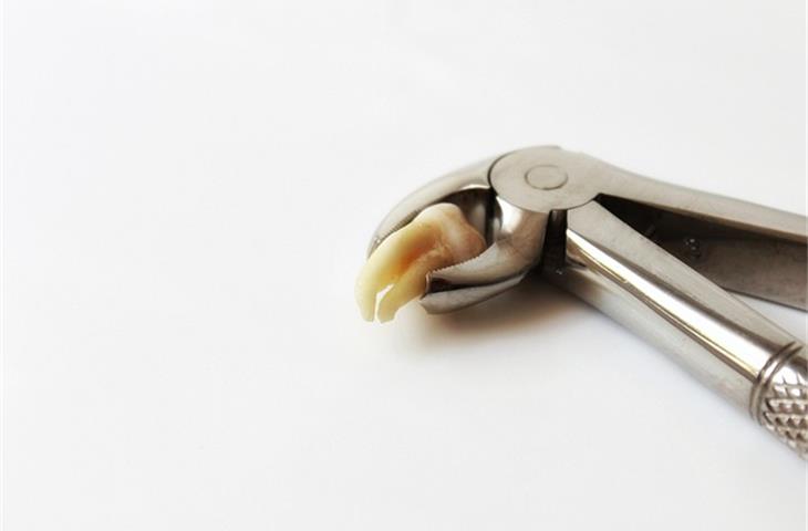 Tooth extraction forceps