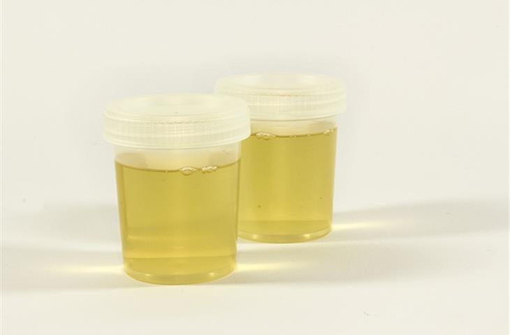 what testing equipment is used for a chorionic villus sampling?