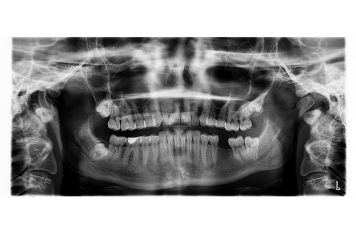 X-ray machines