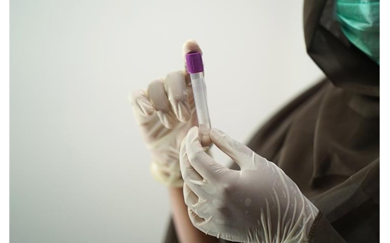 Why UV Aging Test Chambers Are Essential for Quality Assurance