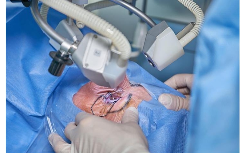 The Essential Guide to Surgery Cutting Instruments: Who Needs What?